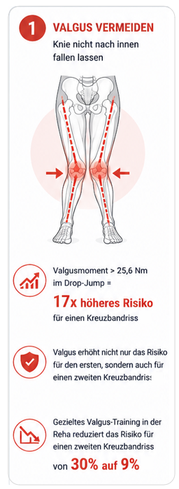 Techniktraining nach Kreuzbandriss. Valgusbewegung reduzieren zur Prävention von Kreuzbandrissen.